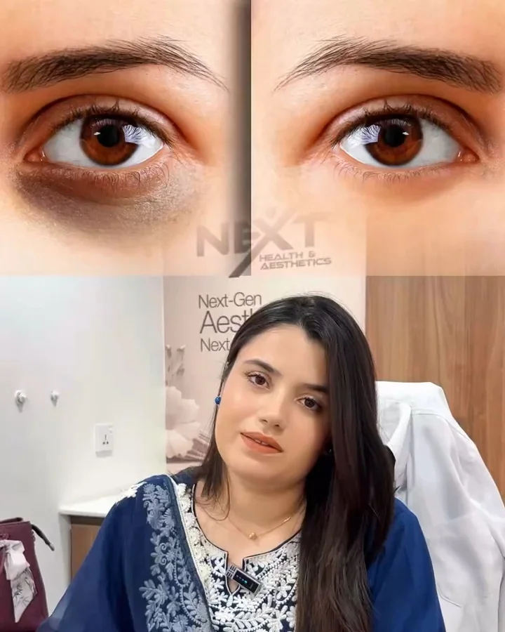 Patient-focused treatment moment