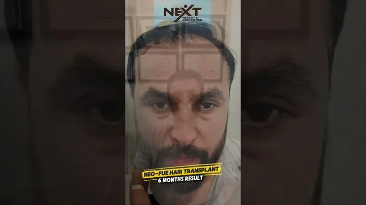 Inside Next Health and Aesthetics