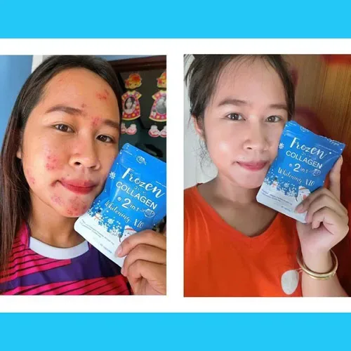 Gluta Frozen Full Body Whitening Capsules (60 Collagen Capsule) 2 in 1